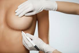 Unlocking Self-Confidence: The Art and Science of Breast Augmentation